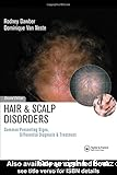 Hair and scalp disorders