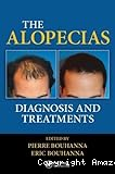 The Alopecias: Diagnosis and Treatments